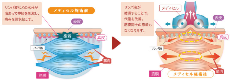 徳島にある整体・耳つぼダイエット『ひろスポーツ整体院』 治癒力